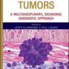 Soft Tissue Tumors: A Multidisciplinary, Decisional Diagnostic Approach Soft Tissue Tumors: A Multidisciplinary, Decisional Diagnostic Approach