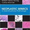Neoplastic Mimics in Genitourinary Pathology (Pathology of Neoplastic Mimics) 1st Edition Neoplastic Mimics in Genitourinary Pathology (Pathology of Neoplastic Mimics) 1st Edition