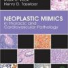 Neoplastic Mimics in Thoracic and Cardiovascular Pathology (Pathology of Neoplastic Mimics) 1st Edition Neoplastic Mimics in Thoracic and Cardiovascular Pathology (Pathology of Neoplastic Mimics) 1st Edition