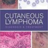 Cutaneous Lymphoma: Diagnosis and Treatment 1st Edition PDF Cutaneous Lymphoma: Diagnosis and Treatment 1st Edition PDF