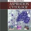 Atlas of Fine Needle Aspiration Cytology 1st Edition PDF Atlas of Fine Needle Aspiration Cytology 1st Edition PDF