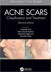 Acne Scars: Classification and Treatment, 2nd Edition PDF Acne Scars: Classification and Treatment, 2nd Edition PDF