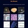 WHO Classification of Tumours of the Breast (IARC WHO Classification of Tumours) WHO Classification of Tumours of the Breast (IARC WHO Classification of Tumours)