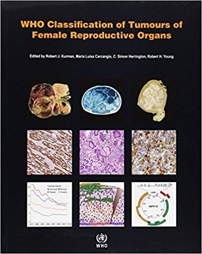 WHO Classification of Tumours of the Female Reproductive Organs (IARC WHO Classification of Tumours) WHO Classification of Tumours of the Female Reproductive Organs (IARC WHO Classification of Tumours)