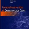 Comprehensive Atlas of Dermatoscopy Cases 1st ed. 2018 Edition Comprehensive Atlas of Dermatoscopy Cases 1st ed. 2018 Edition