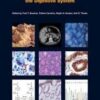 WHO Classification of Tumours of the Digestive System (IARC WHO Classification of Tumours) 4th Edition WHO Classification of Tumours of the Digestive System (IARC WHO Classification of Tumours) 4th Edition
