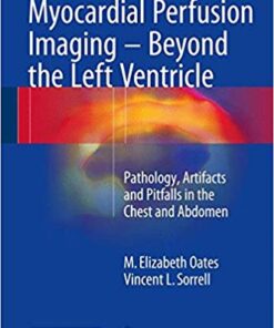 Myocardial Perfusion Imaging – Beyond the Left Ventricle: Pathology, Artifacts and Pitfalls in the Chest and Abdomen 1st ed. 2017 Edition