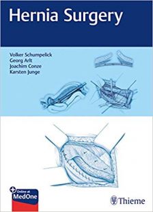 Hernia Surgery PDF
