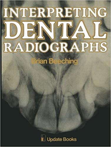 Interpreting Dental Radiographs Softcover reprint of the original 1st ed. 1981 Edition pdf