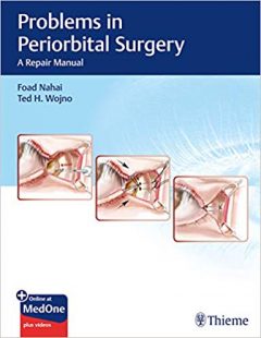 VIDEO & PDF Problems in Periorbital Surgery: A Repair Manual VIDEO & PDF Problems in Periorbital Surgery: A Repair Manual