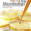 Atlas of Oral Microbiology: From Healthy Microflora to Disease 1st Edition Atlas of Oral Microbiology: From Healthy Microflora to Disease 1st Edition
