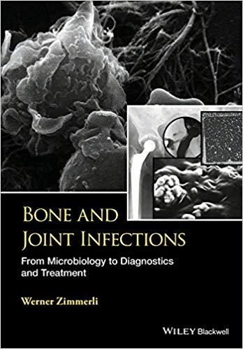 Bone and Joint Infections: From Microbiology to Diagnostics and Treatment 1st Edition Bone and Joint Infections: From Microbiology to Diagnostics and Treatment 1st Edition