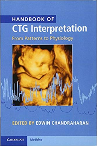 Handbook of CTG Interpretation: From Patterns to Physiology 1st Edition Handbook of CTG Interpretation: From Patterns to Physiology 1st Edition