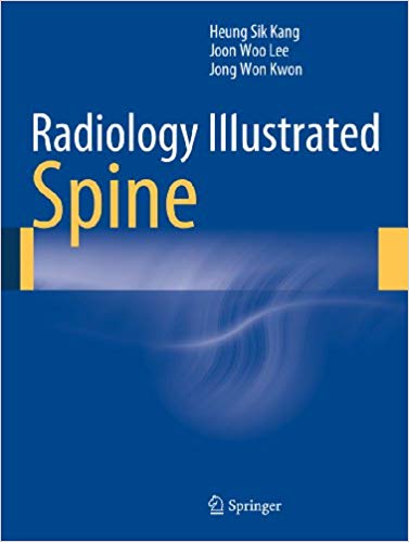 Radiology Illustrated: Spine 2014 Edition PDF Radiology Illustrated: Spine 2014 Edition PDF
