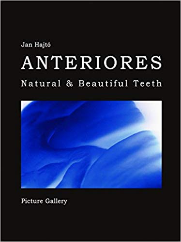 Anteriores-Natural & Beautiful Teeth-Picture Gallery (Korean Edition) (Korean) PDF