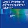 Surgical Treatment of Ankylosing Spondylitis Deformity 1st ed. 2019 Edition PDF Surgical Treatment of Ankylosing Spondylitis Deformity 1st ed. 2019 Edition PDF