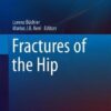 Fractures of the Hip (Fracture Management Joint by Joint) 1st ed. 2019 Edition PDF Fractures of the Hip (Fracture Management Joint by Joint) 1st ed. 2019 Edition PDF