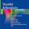 Shoulder Arthroplasty: The Shoulder Club Guide 1st ed. 2020 Edition PDF