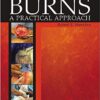 Burns: A Practical Approach to Immediate Treatment and Long Term Care 1st Edition PDF Burns: A Practical Approach to Immediate Treatment and Long Term Care 1st Edition PDF