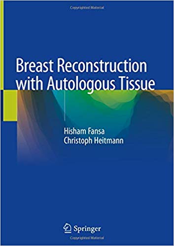 Breast Reconstruction with Autologous Tissue 1st ed. 2019 Edition PDF Breast Reconstruction with Autologous Tissue 1st ed. 2019 Edition PDF