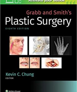 Grabb and Smith’s Plastic Surgery Eighth Edition PDF