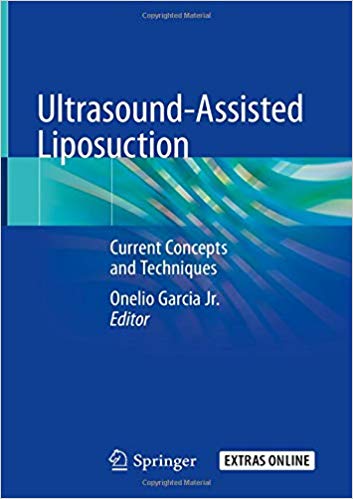 Ultrasound-Assisted Liposuction: Current Concepts and Techniques 1st ed. 2020 Edition PDF Ultrasound-Assisted Liposuction: Current Concepts and Techniques 1st ed. 2020 Edition PDF
