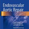 Endovascular Aortic Repair: Current Techniques with Fenestrated, Branched and Parallel Stent-Grafts 1st ed. 2017 Edition PDF Endovascular Aortic Repair: Current Techniques with Fenestrated, Branched and Parallel Stent-Grafts 1st ed. 2017 Edition PDF