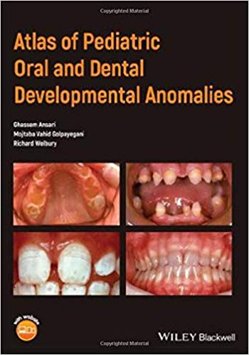 Atlas of Pediatric Oral and Dental Developmental Anomalies 1st Edition PDF