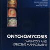 Onychomycosis: Diagnosis and Effective Management 1st Edition PDF Onychomycosis: Diagnosis and Effective Management 1st Edition PDF