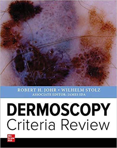 Dermoscopy Criteria Review 1st Edition PDF Dermoscopy Criteria Review 1st Edition PDF