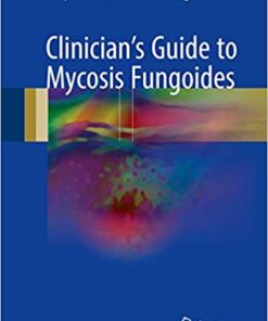 Clinician’s Guide to Mycosis Fungoides 1st ed. 2017 Edition PDF