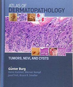 Atlas of Dermatopathology: Tumors, Nevi, and Cysts 1st Edition PDF