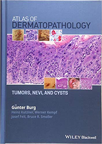 Atlas of Dermatopathology: Tumors, Nevi, and Cysts 1st Edition PDF Atlas of Dermatopathology: Tumors, Nevi, and Cysts 1st Edition PDF