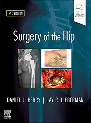 Surgery of the Hip 2nd Edition PDF Surgery of the Hip 2nd Edition PDF