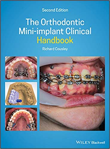 The Orthodontic Mini-implant Clinical Handbook 2nd Edition PDF