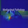 Mediastinal Pathology 1st ed. 2019 Edition PDF Mediastinal Pathology 1st ed. 2019 Edition PDF