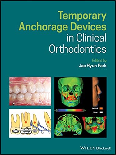 Temporary Anchorage Devices in Clinical Orthodontics 1st Edition PDF