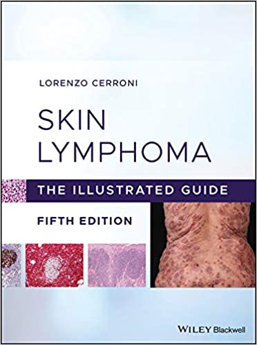 Skin Lymphoma: The Illustrated Guide 5th Edition PDF Skin Lymphoma: The Illustrated Guide 5th Edition PDF