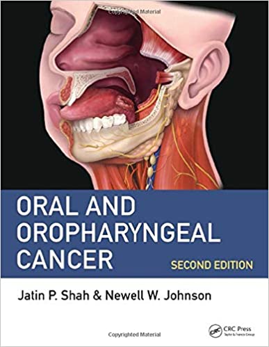 Oral and Oropharyngeal Cancer 2nd Edition PDF Oral and Oropharyngeal Cancer 2nd Edition PDF