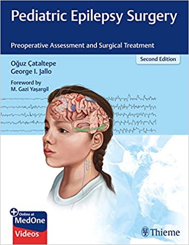 Pediatric Epilepsy Surgery: Preoperative Assessment and Surgical Treatment 2nd Edition PDF
