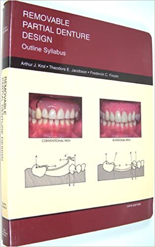Removable partial denture design: Outline syllabus PDF