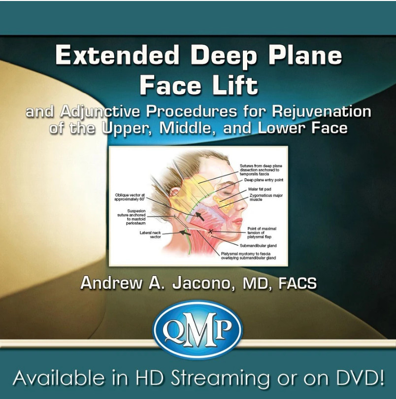 Extended Deep Plane Face Lift and Adjunctive Procedures for Rejuvenation of the Upper, Middle, and Lower Face Extended Deep Plane Face Lift and Adjunctive Procedures for Rejuvenation of the Upper, Middle, and Lower Face