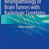 Neuropathology of Brain Tumors with Radiologic Correlates 1st ed. 2020 Edition PDF Neuropathology of Brain Tumors with Radiologic Correlates 1st ed. 2020 Edition PDF
