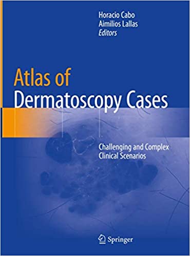 Atlas of Dermatoscopy Cases: Challenging and Complex Clinical Scenarios 1st ed. 2020 Edition PDF Atlas of Dermatoscopy Cases: Challenging and Complex Clinical Scenarios 1st ed. 2020 Edition PDF