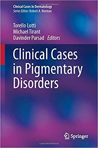 Clinical Cases in Pigmentary Disorders 1st ed. 2020 Edition PDF Clinical Cases in Pigmentary Disorders 1st ed. 2020 Edition PDF
