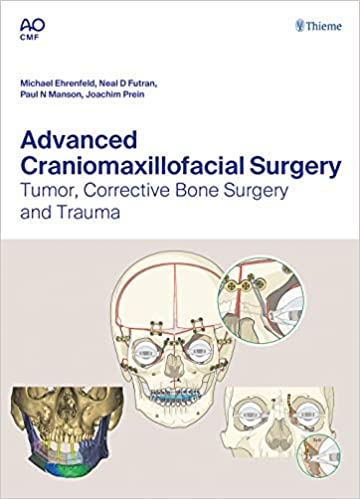 Advanced Craniomaxillofacial Surgery 1st Edition PDF Advanced Craniomaxillofacial Surgery 1st Edition PDF