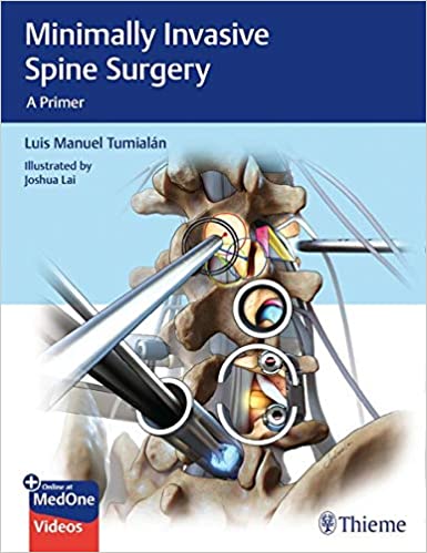 Minimally Invasive Spine Surgery 1st Edition PDF Minimally Invasive Spine Surgery 1st Edition PDF