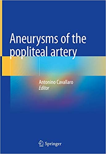 Aneurysms of the Popliteal Artery 1st ed. 2021 Edition PDF Aneurysms of the Popliteal Artery 1st ed. 2021 Edition PDF