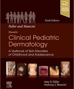 Paller and Mancini – Hurwitz Clinical Pediatric Dermatology: A Textbook of Skin Disorders of Childhood & Adolescence 6th Edition PDF