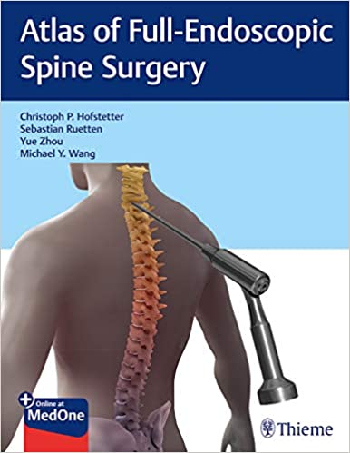 Atlas of Full-Endoscopic Spine Surgery 1st Edition PDF Atlas of Full-Endoscopic Spine Surgery 1st Edition PDF